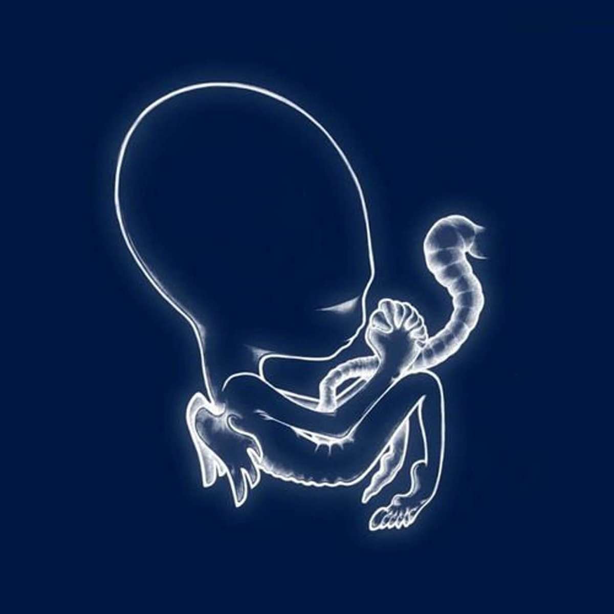 Ágætis byrjun by Sigur Rós